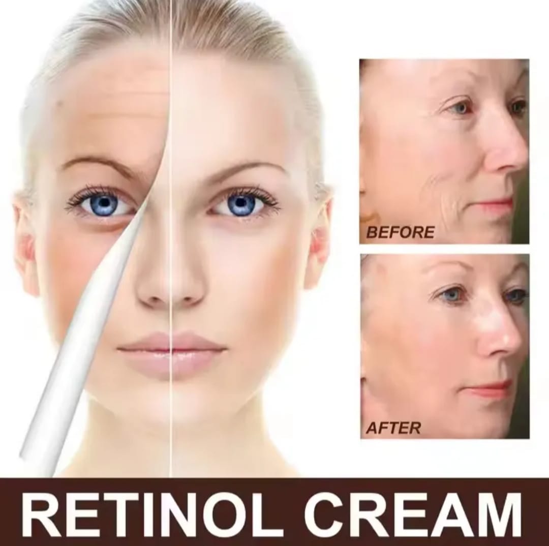 Botox-krem