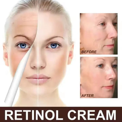 Botox-krem