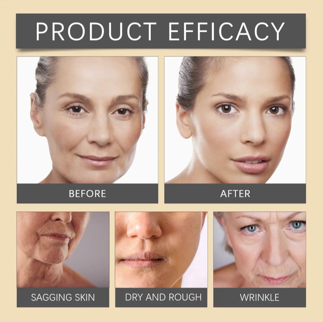 Botox-krem