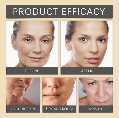 Botox-krem