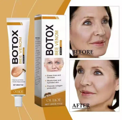 Botox-krem